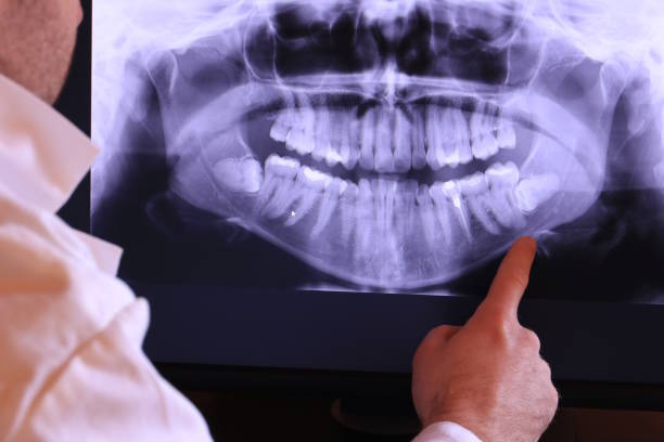 Best Emergency Dental Services for Seniors in Mulberry, OH
